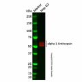 Recombinant alpha 1 Antitrypsin Antibody