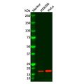 Recombinant alpha Synuclein Antibody
