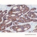 AMACR Mouse mAb