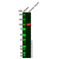 Angiostatin Mouse mAb