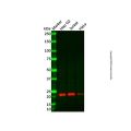 ATP5H Antibody