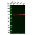 Recombinant ATP6V1A Antibody