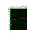 Recombinant ATPB Antibody