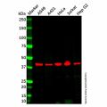 BAAT Antibody