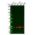 Recombinant Bad Antibody