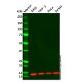 Beta 2 Microglobulin Mouse mAb