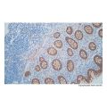 Recombinant beta Catenin Antibody