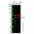 Recombinant BLNK Antibody
