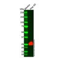 Recombinant BNIP3 Antibody