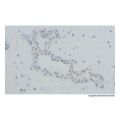 Recombinant BRCA1 Antibody