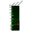 Recombinant Calretinin Antibody
