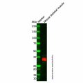 Recombinant Cardiac Troponin T Antibody