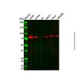 Recombinant CARS Antibody
