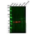 Recombinant CCR8 Antibody