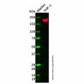 Recombinant CD11a Antibody