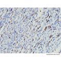 CD163 Mouse mAb