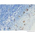 Recombinant CD1a Antibody
