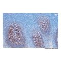 Recombinant CD35 Antibody