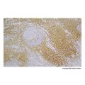 Recombinant CD5 Antibody