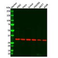 Recombinant CDK1 Antibody
