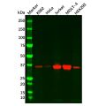 Recombinant Cdk6 Antibody