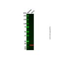Recombinant CDKN2A/p16INK4a Antibody