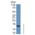 Calcitonin/CALCA Antibody