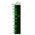 Recombinant Chk2 Antibody