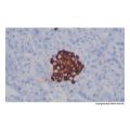 Recombinant Chromogranin A Antibody