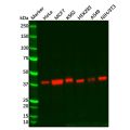 Recombinant CT A Antibody