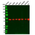 Recombinant CTBP2 Antibody