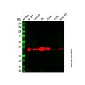 Recombinant Cyclin D1 Antibody