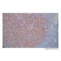 Recombinant Cyclin D1 Antibody