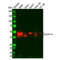 Recombinant Cyclin E1 Antibody