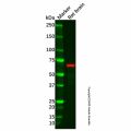 Recombinant Cytokeratin 1 Antibody