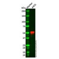 Recombinant Cytokeratin 13 Antibody