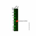 Recombinant Cytokeratin 16/K16 Antibody