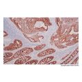 Recombinant Cytokeratin 19 Antibody