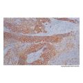 Recombinant Cytokeratin 5 + 6 Antibody