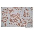 Recombinant Cytokeratin 7 Antibody