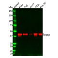 Recombinant DDB2 Antibody