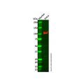 Recombinant Desmocollin 3 Antibody