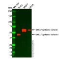 Recombinant DKC1/Dyskerin Antibody