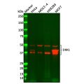 Recombinant DKK1 Antibody