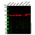 DYRK1A Antibody