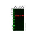 EEF2K Antibody