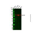 EIF2B5 Antibody