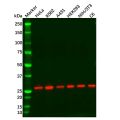 Recombinant eIF4E Antibody