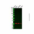 Recombinant ERAB Antibody