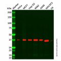 Recombinant ERCC1 Antibody